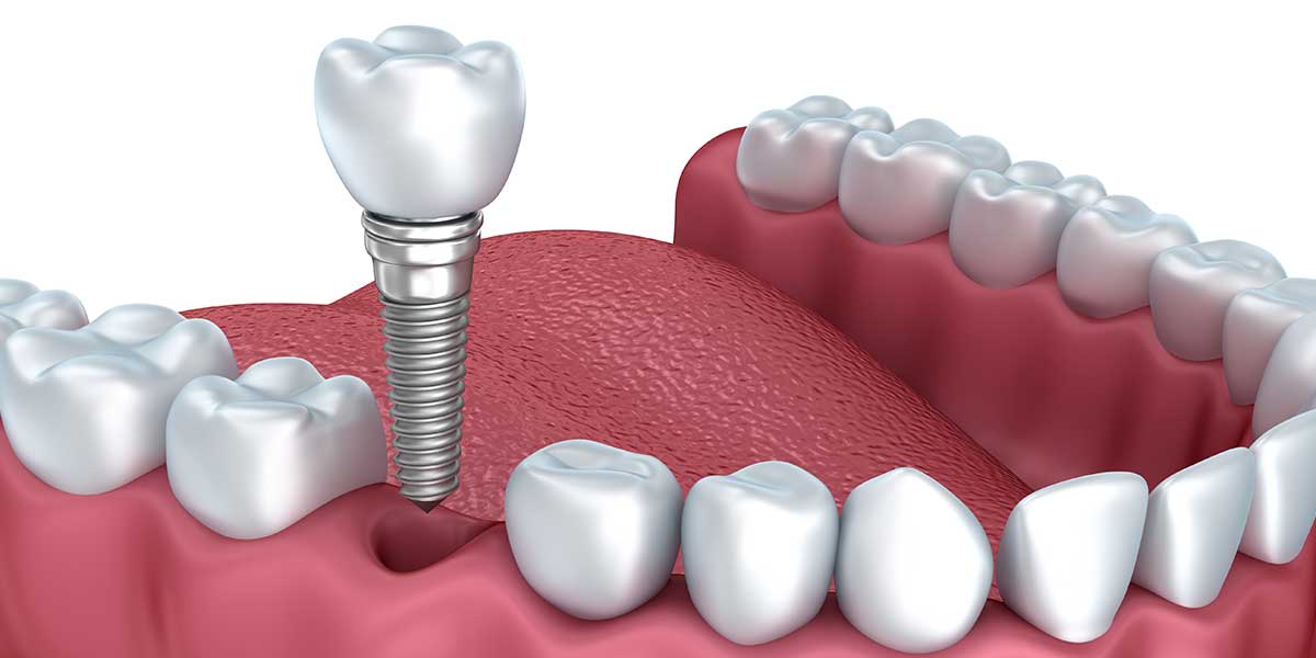 Dr Thabsheer's Zenith Dental Care